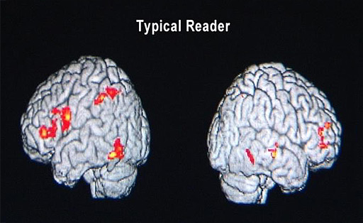 Slide Show Image